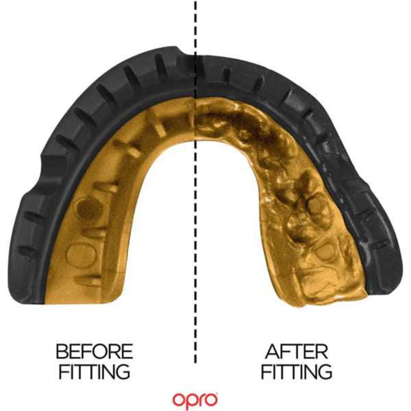 Adult Self-Fit Mouthguard For Braces